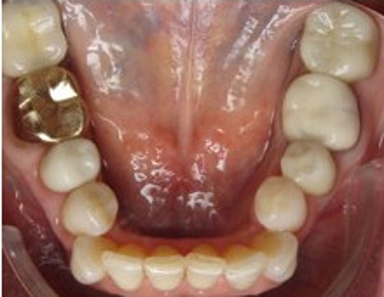 Fig. 9c: Before. 