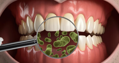 Antibiotikaresistenz im Mund: Neue Einblicke in das orale Resistom