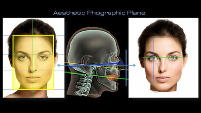 Aesthetic Digital Smile Design ADSD : dentisterie esthétique assistée par ordinateur – Partie I