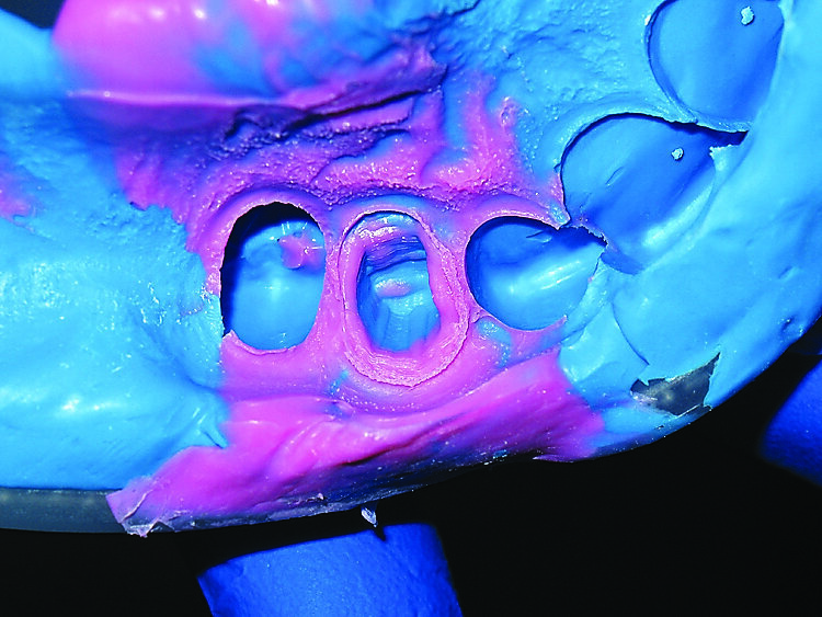 Fig. 10. Detail of impression