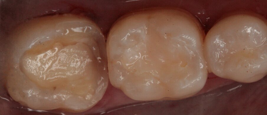 Fig. 28_Build-up di 47.