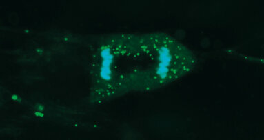 Ricerca ed evoluzione per le tecniche di riabilitazione implantoprotesica