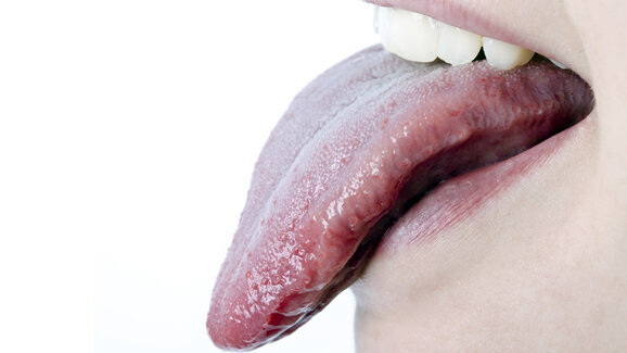 Speicheltest könnte Diagnostik verbessern