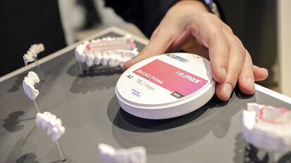 IPS e.max ZirCAD Prime—Redefining zirconia