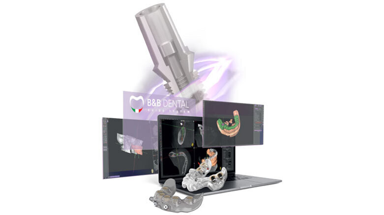 B&B Dental ti guida verso l’innovazione in chirurgia
