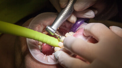 Stanowisko FDI wobec leczenia zachowawczego i próchnicy głębokiej