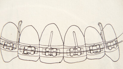 A review of the original Combination Technique and philosophy A review of the original Combination Technique and philosophy