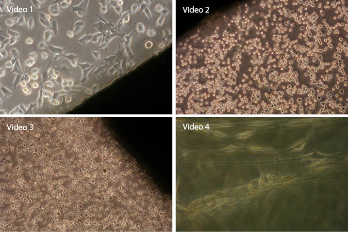 Video 1: Zirkon – Pozitivní reakce na vzorek zirkonia. Buňky reagují dobrou adhezí a dilatací, probíhá buněčné dělení Video 2: Alzona – Kolem vzorku aluminia se postupně vytváří zóna odumírajících buněk, dál od povrchu vzorku jsou buňky živé Video 3: Indium – Zcela negativní reakce na vzorek india. Buňky reagují odumíráním, a to postupně od hrany vzorku. Video 4: Nanovlákno – Interakce buněk s mikro- a nanovlákny s PCL. Buňky adherují k vláknu, jsou schopny pohybu a co je důležité – dělí se. Reakce buněk je pozitivní.
