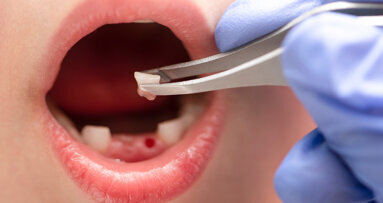 Biologisches Gedächtnis im Zahn: Frühbelastung mit Schwermetallen