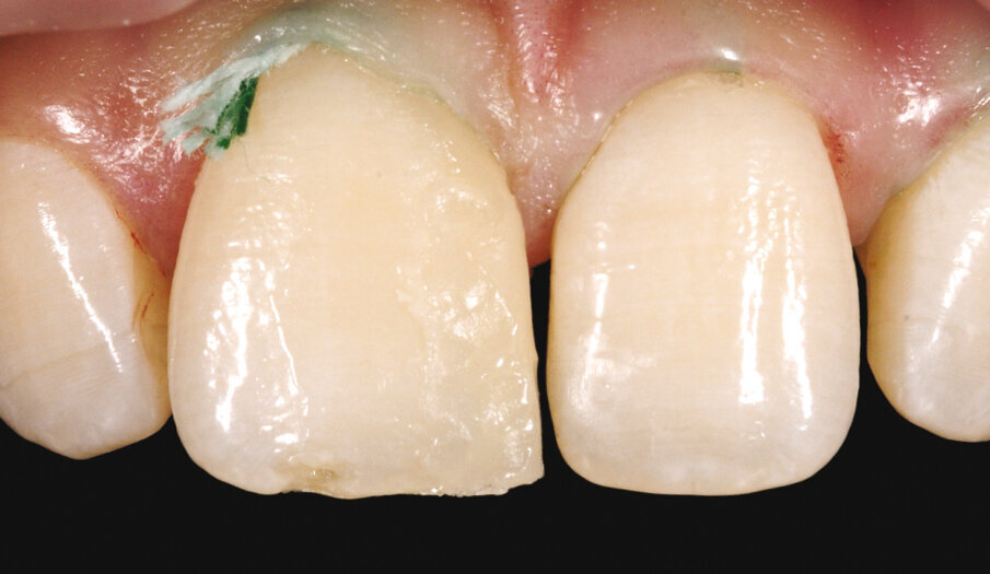6. Slika nakon nanošenja sloja Ivory (Inspiro) preko strukture izgrađene osnovnom bojom.