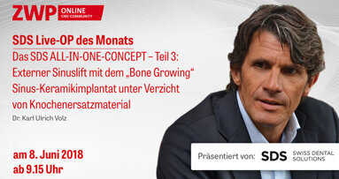 Live-OP am 8. Juni : Das SDS ALL-IN-ONE-CONCEPT – Teil 3
