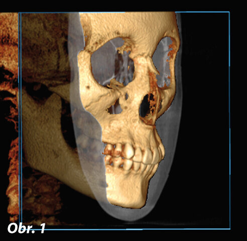 Pohled na 3D rekonstrukci