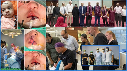 First welfare cleft mission by JMDC