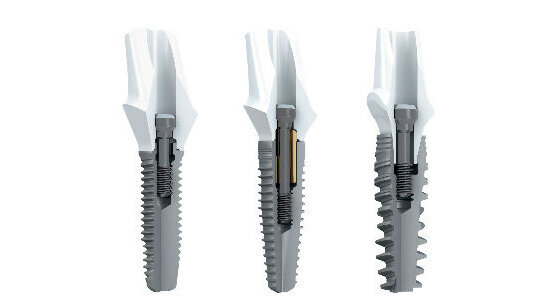 Nobel Biocare annuncia collaborazione con 3Shape