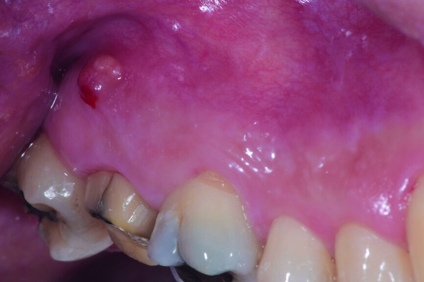 Fig. 2: Pre-op facial view.