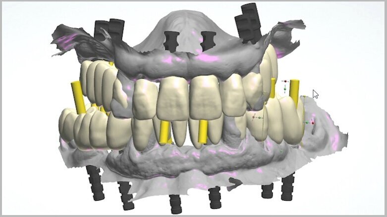 The fully digital Pro Arch protocol