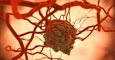 Kampagne der EHNS gegen Kopf-Hals-Krebs