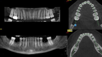 Mobile CBVI vans give dentists benefits of the technology without the cost