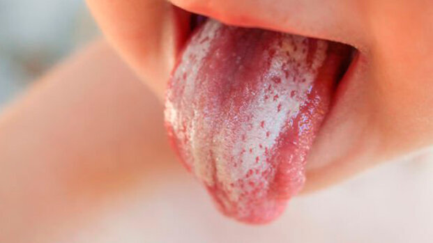 Nuove sostanze per il controllo delle risposte infiammatorie provocate da infezioni fungine