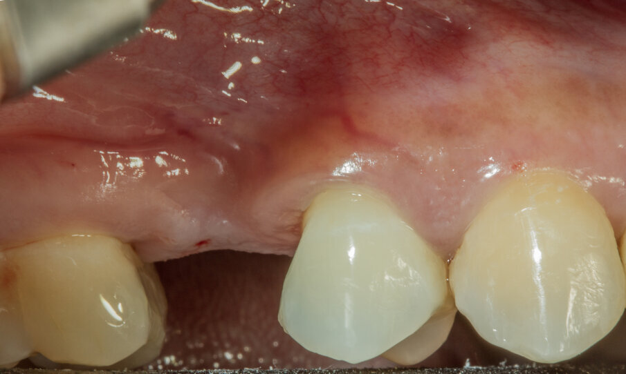 Fig. 2 - Situazione iniziale.