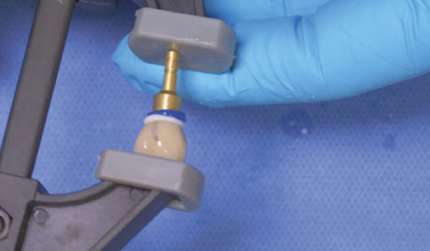 Fig. 10: Place the crown and the implant into clamps and lightly tighten. 