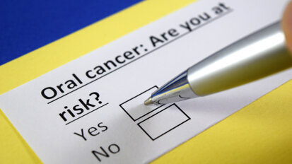 Mouth cancer rates skyrocket in UK
