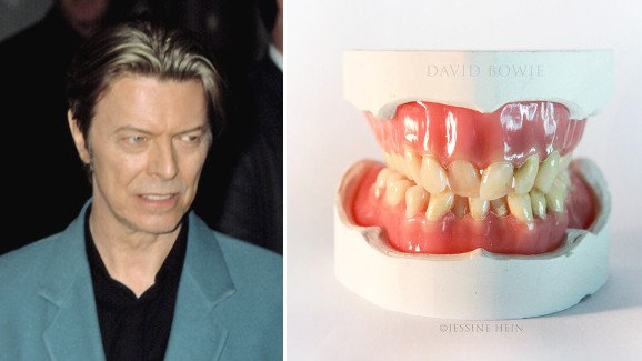 Interview : «  Les dents de Bowie étaient comme tout le reste chez lui : différentes »