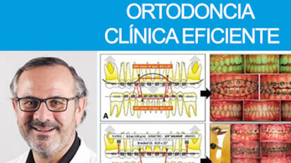Curso de Ortodoncia Eficiente en Ortoplus