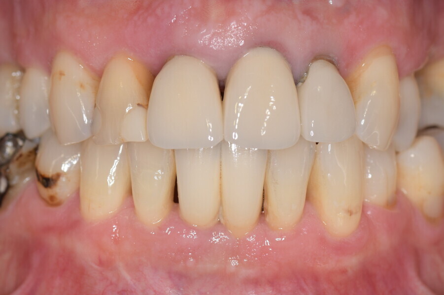 Fig. 1b: Initial situation.