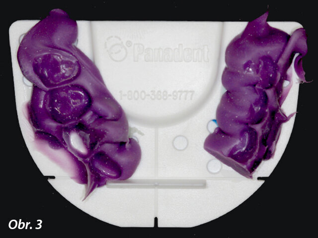 Obr. 3: Indexový nosič s materiálem pro registraci skusu