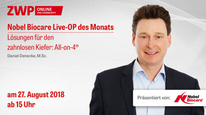 Nobel Biocare Live-OP: Das All-on-4-Behandlungskonzept Nobel Biocare Live-OP: Das All-on-4-Behandlungskonzept