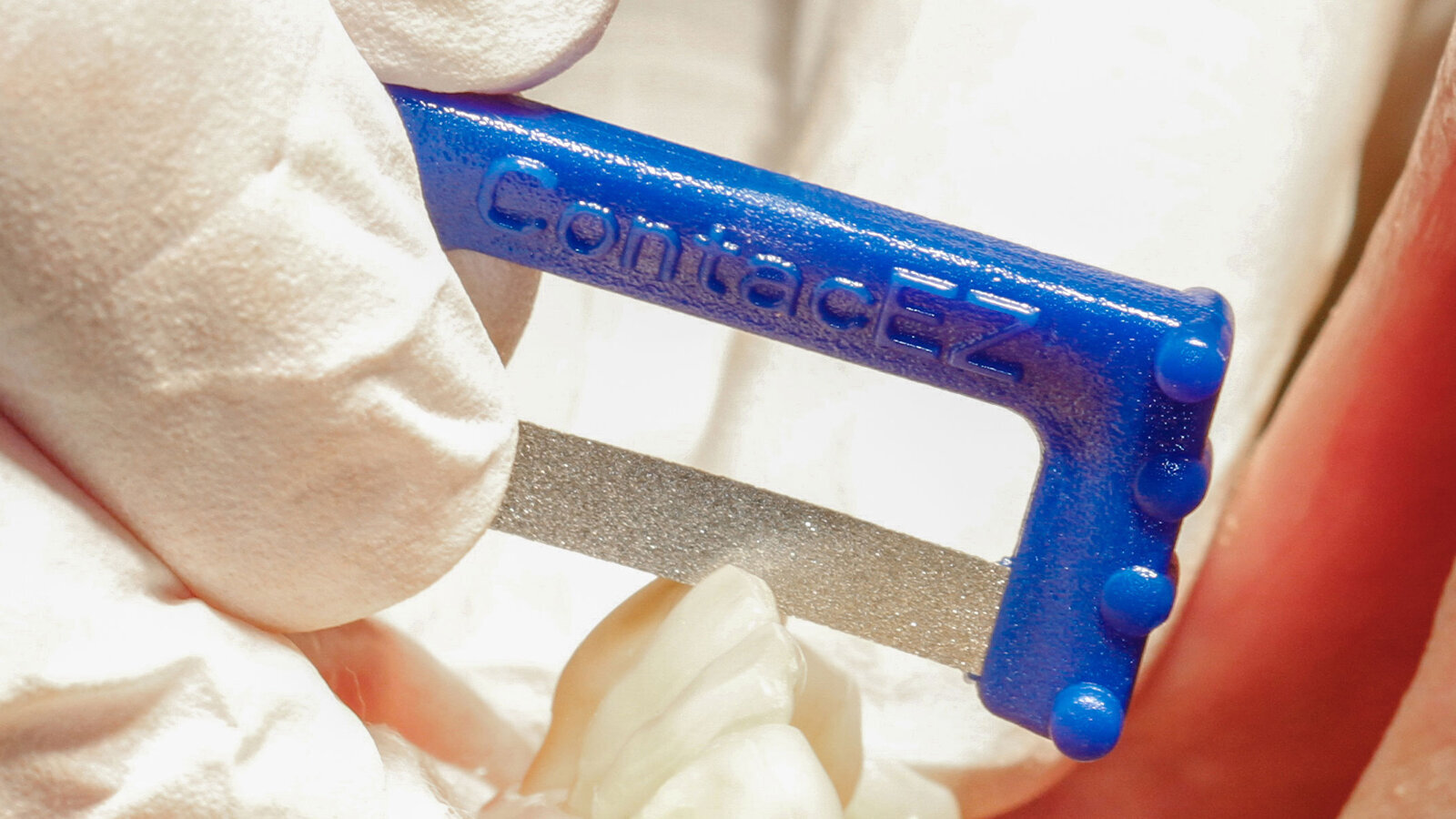 Excellence made easy: A Story of ContacEZ innovation