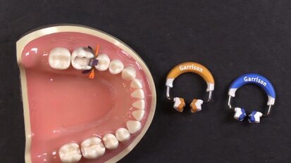 Quick Tip #2 | Angle the Ring for Easier Placement