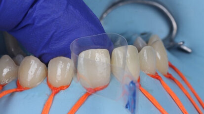 Optimizing aesthetic outcomes with Haji’s  matrix technique