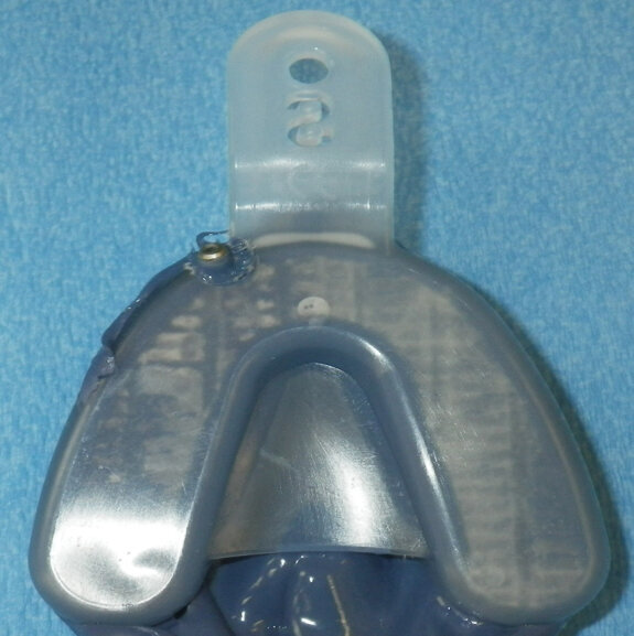Fig. 13. The impression has been removed from the mouth and is ready for inspection.