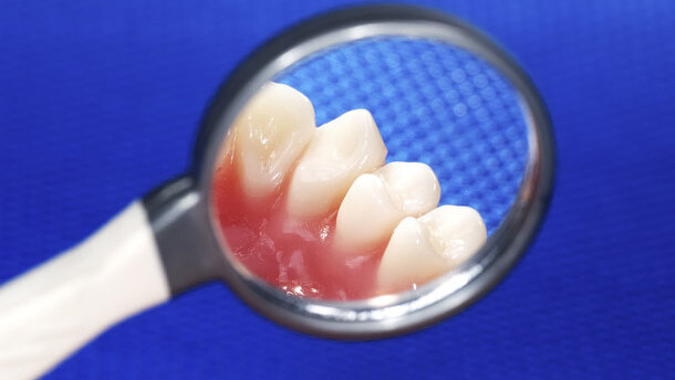 Harde woorden PvdA-kamerlid over vrije tarieven