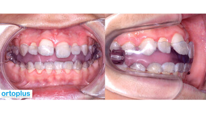 Fabrican el primer Teuscher 100% digital