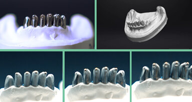 SCANTIST 3D — odkryj pierwszy aerozol do skanowania 3D, który odparowuje automatycznie po 20 minutach