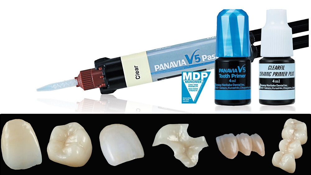 ΟΔΗΓΟΣ ΓΙΑ ΤΗΝ ΕΠΙΤΥΧΗ ΣΥΓΚΟΛΛΗΣΗ ΠΡΟΣΘΕΤΙΚΩΝ ΑΠΟΚΑΤΑΣΤΑΣΕΩΝ