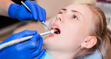 USA: stanziati 2 milioni e mezzo di dollari per lo sviluppo di materiali da otturazione