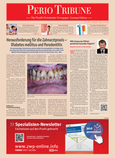 Perio Tribune Germany No. 1, 2015