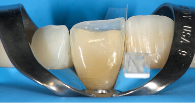 Essentia – Chytré zjednodušení kompozitního systému!