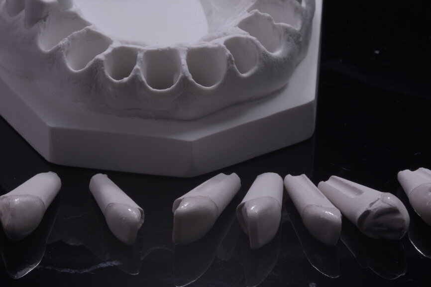 Fig. 63: Alveolar model.