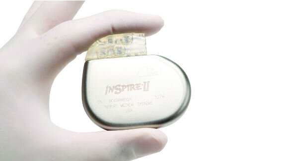 Un nouvel appareil implantable pourrait aider les patients souffrant d’apnée du sommeil