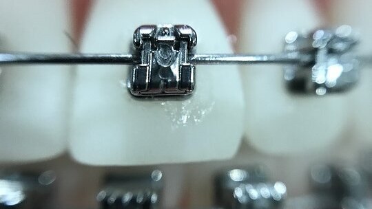 Diagnostyka rezonansem magnetycznym u pacjentów ortodontycznych