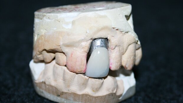 Krunica napravljena za Elvisa Prislija prodata na aukciji