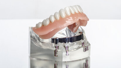 Studie bestätigt: Senioren ziehen „feste Zähne“ einer Prothese vor