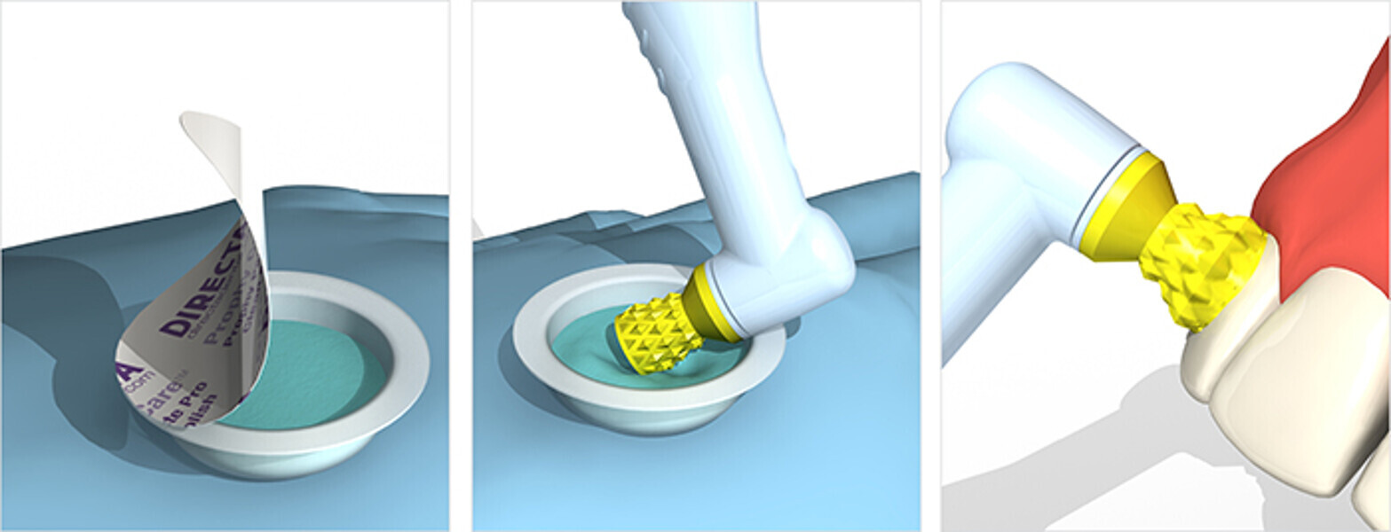 technique prophycare