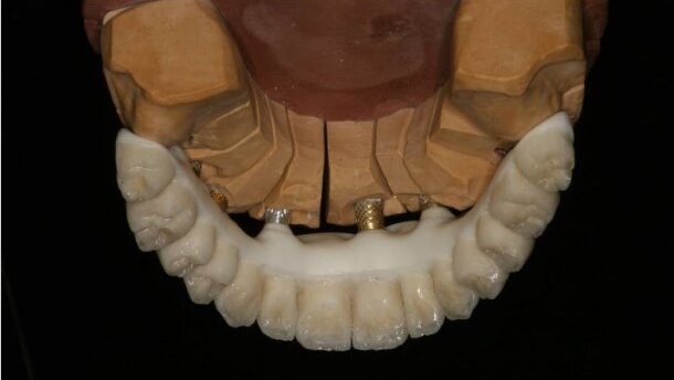 Korony teleskopowe nowej ery – część 2