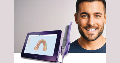 Align Technology continua  a rivoluzionare la pianificazione  dei trattamenti odontoiatrici  e restaurativi con le innovazioni  del sistema Invisalign